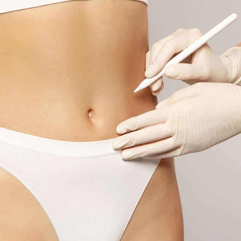 Preparazione Pre-Operatoria per Liposuzione Addome